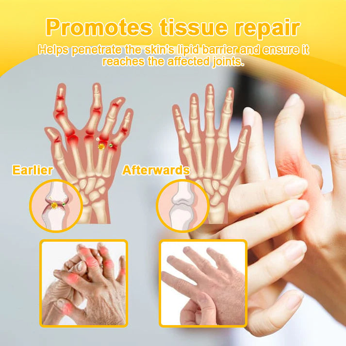 Lotmay® Bee Venom Analgesic Bone Repair Cream(👨⚕️Developed for the elderly,BOA Certification)