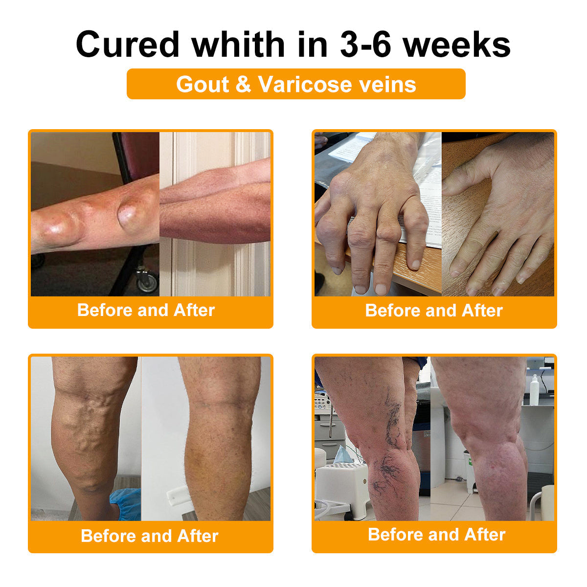 Lotmay® Bee Venom Analgesic Bone Repair Cream(👨⚕️Developed for the elderly,BOA Certification)