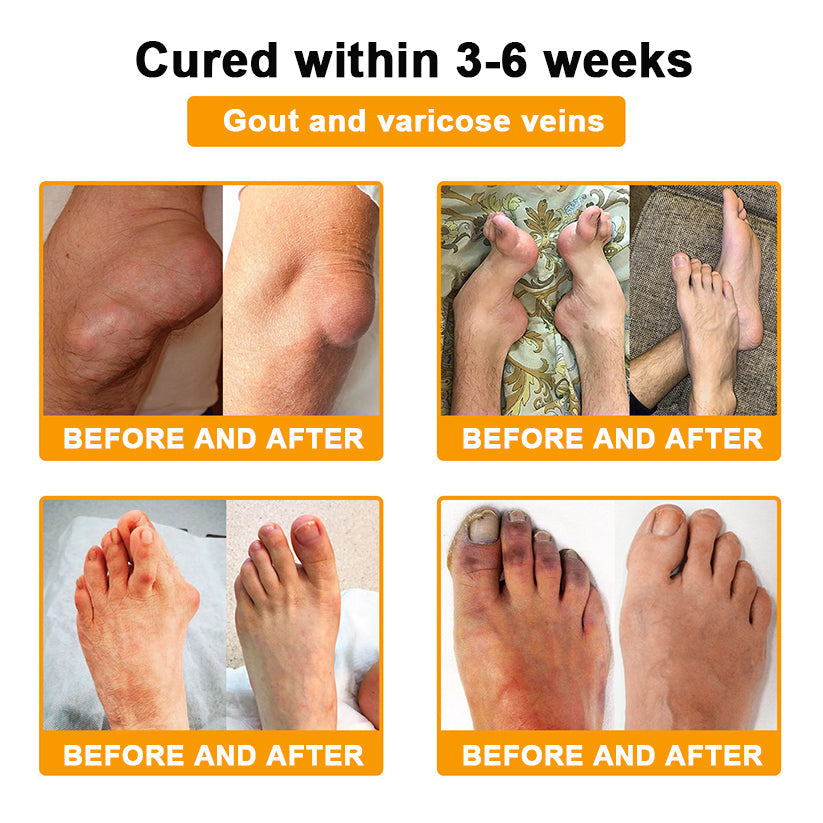 Raindew® 🐝 Botulinum Toxin & Bee Venom Pain-Relief Bone Healing Cream