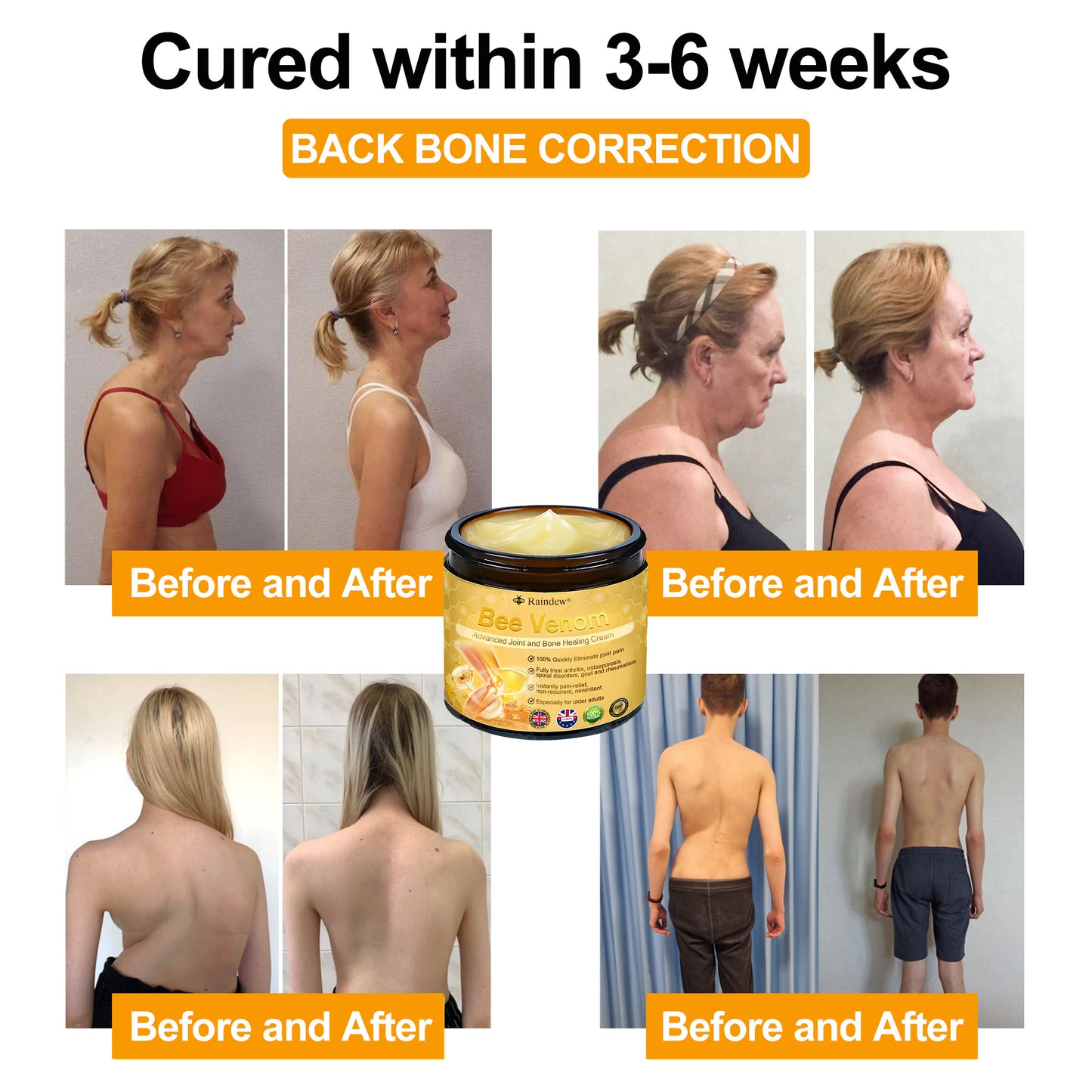 Raindew®Bee Venom Advanced Joint and Bone Healing Cream (👨‍⚕️Specifically developed for middle-aged and older adults)
