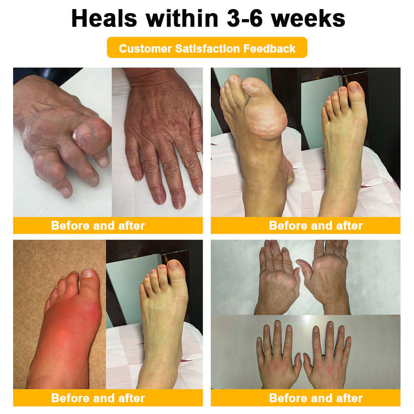 Raindew® Bee Venom Pain-Relief Bone Healing Cream 🐝🐝(Specially for older adults & BOA recommends)