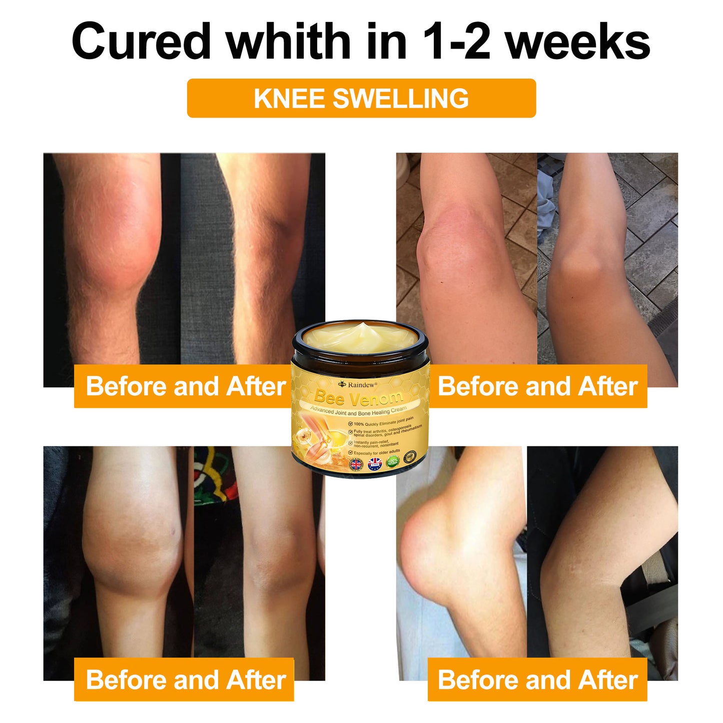 Raindew®Bee Venom Advanced Joint and Bone Healing Cream (👨‍⚕️Specifically developed for middle-aged and older adults)