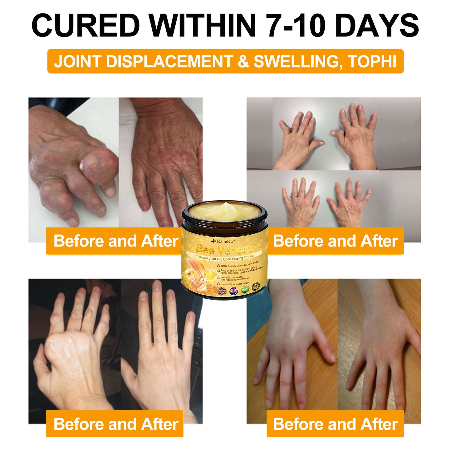 Raindew®Bee Venom Advanced Joint and Bone Healing Cream (👨‍⚕️Specifically developed for middle-aged and older adults)