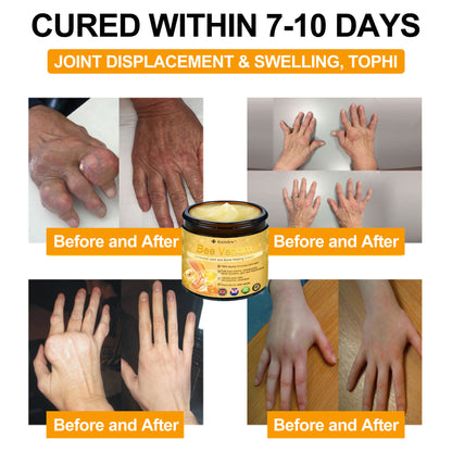 Raindew®Bee Venom Advanced Joint and Bone Healing Cream (👨‍⚕️Specifically developed for middle-aged and older adults)