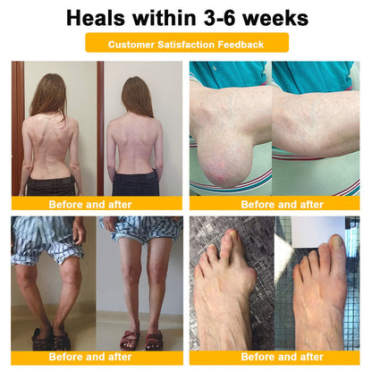 Lotmay® Bee Venom Pain Relief Joint Repair Cream 🐝🐝(Specially for older adults & MHRA approved)