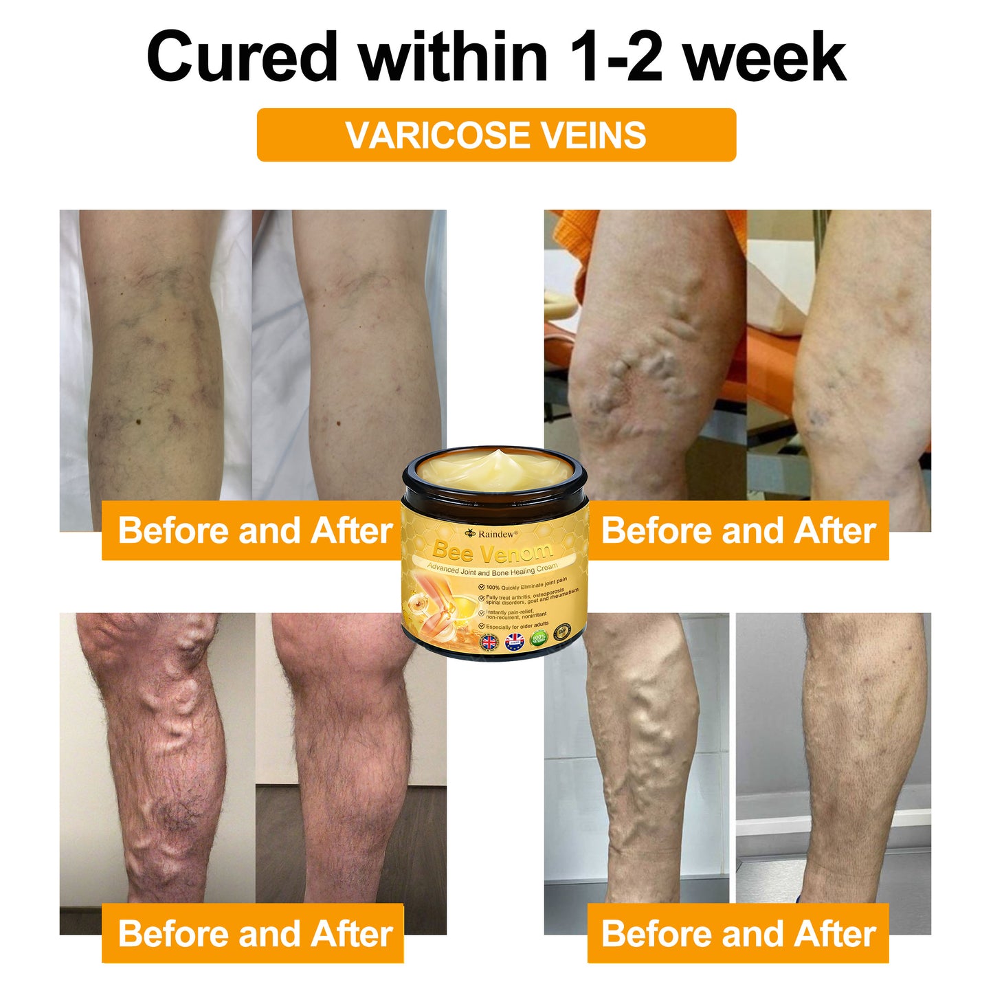 Raindew®Bee Venom Advanced Joint and Bone Healing Cream (👨‍⚕️Specifically developed for middle-aged and older adults)