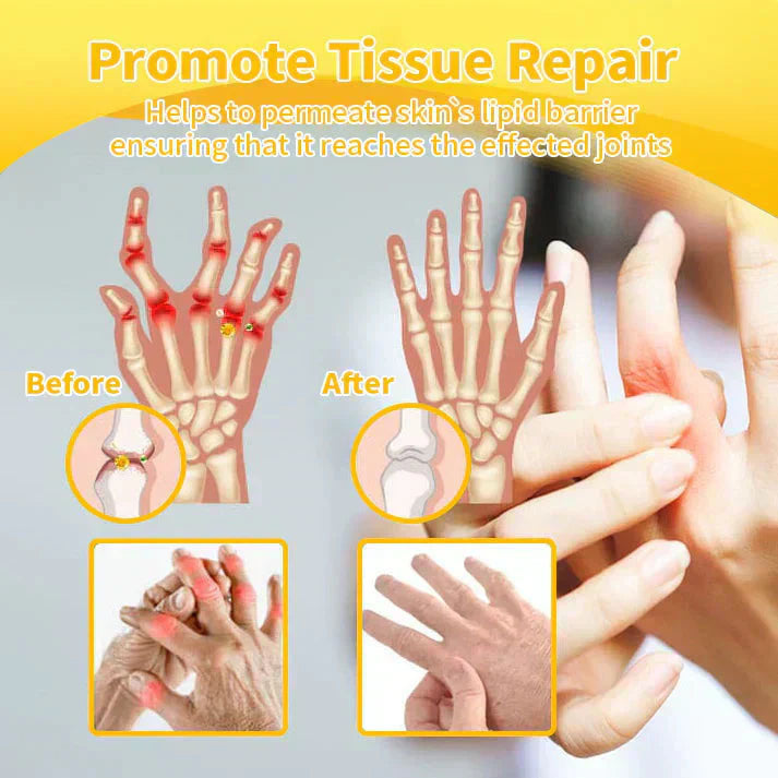 Lotmay® Bee Venom Pain Relief Joint Repair Cream 🐝🐝(Specially for older adults & MHRA approved)