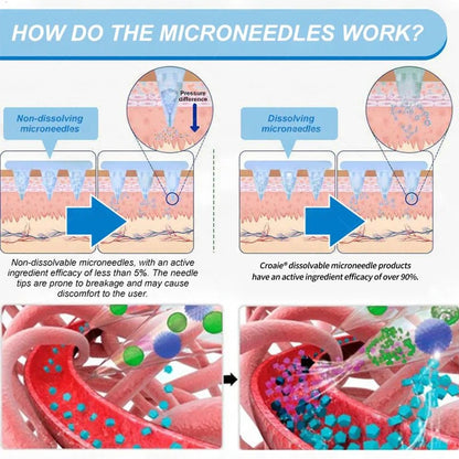 MHRA Official Store |🎁 Croaie® GLP-1 Nano-Microneedle Patch with Collagen & Matrixyl 3000丨Obesity, Cardiovascular Disease, Diabetes, Sleep Apnea, Joint Problems and More